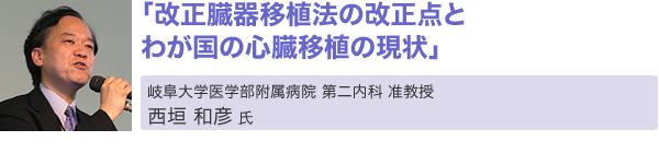 「改正臓器移植法の改正点とわが国の心臓移植の現状」