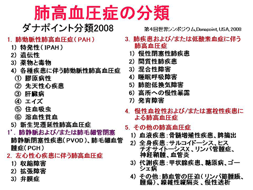 表